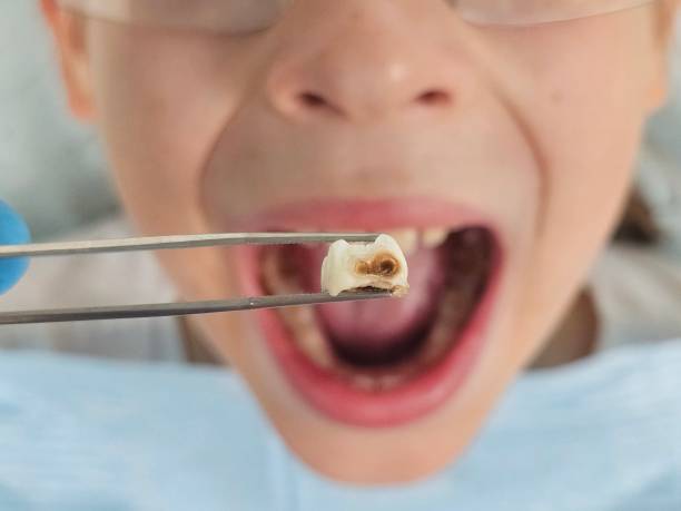 Urgent Tooth Repair in AR